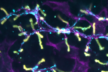 Zur Seite: B. Membrangrenzflächen als Antrieb für Zelldynamik